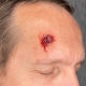 BULLET WOUND - PROSTHETIC FX FLAT MOULD